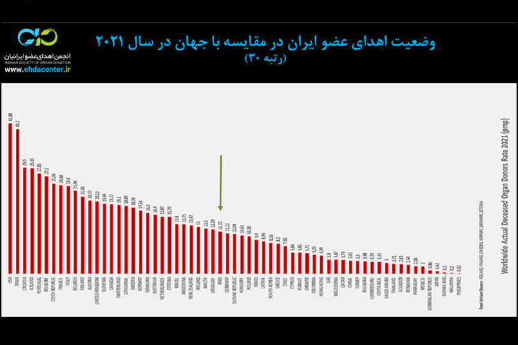 مقایسه آمار اهدای عضو ایران با جهان